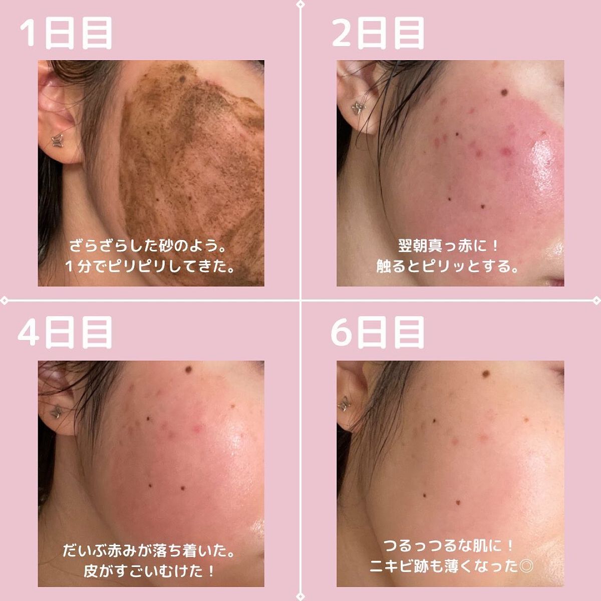 を使ったクチコミ（3枚目）