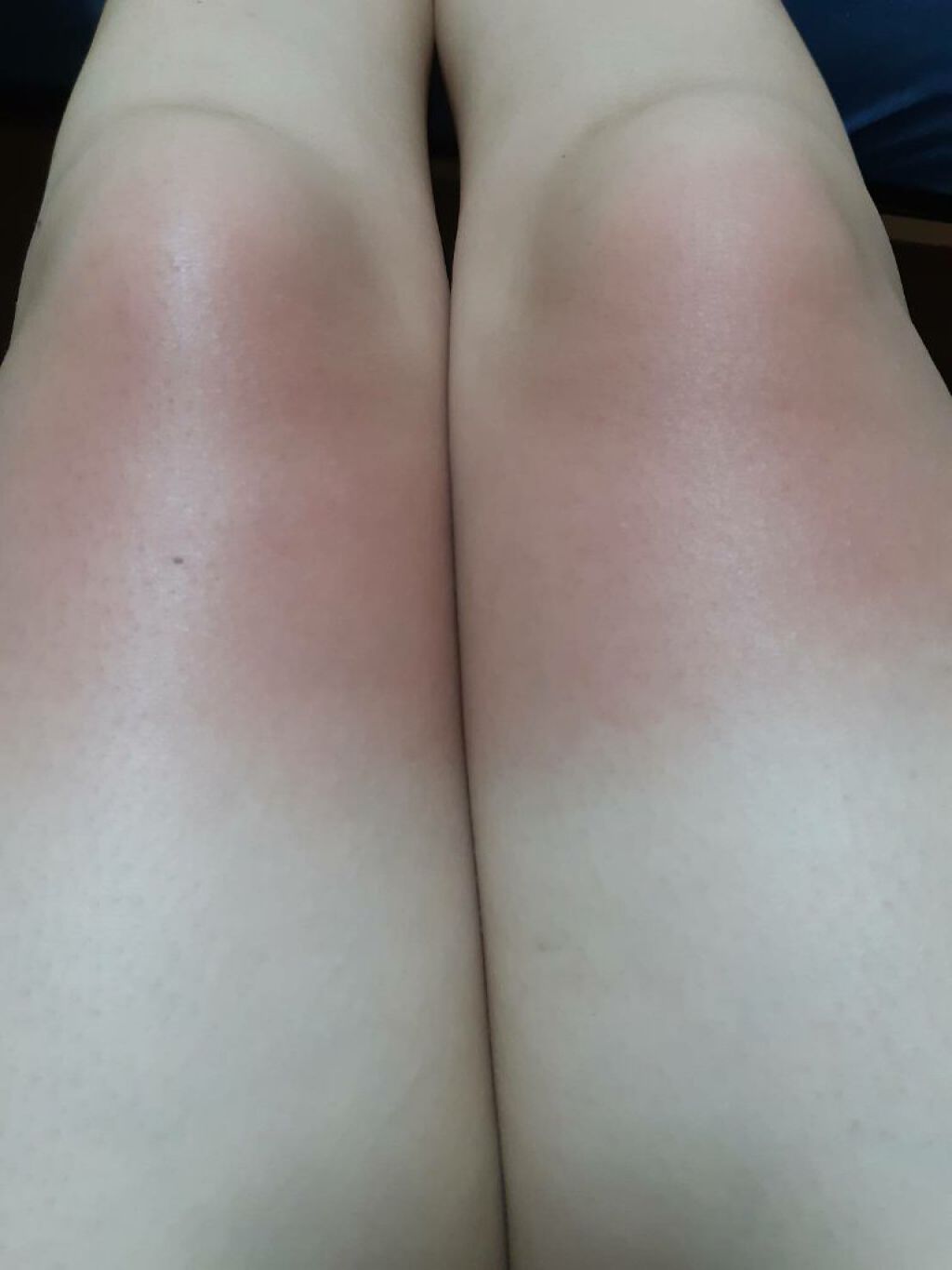 Multi サンクリーム/FOOD A HOLIC /日焼け止めクリームを使ったクチコミ（2枚目）