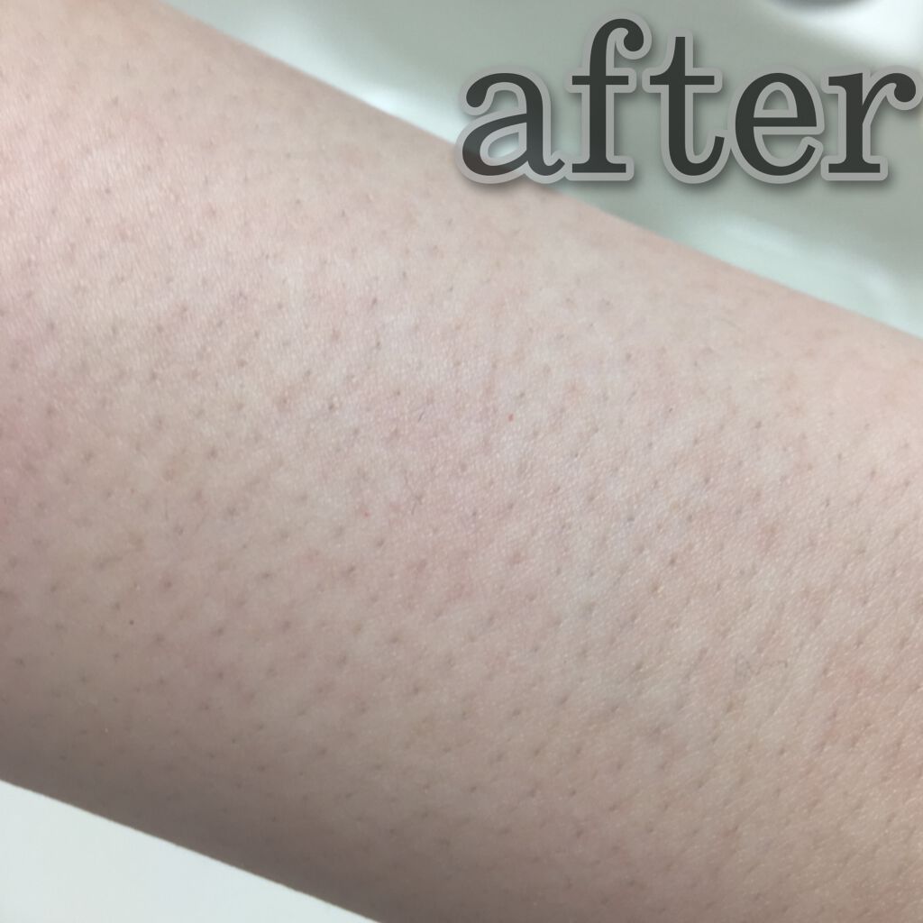 脱毛クリーム MOOMO/自然化粧品研究所/除毛クリームを使ったクチコミ(4枚目)