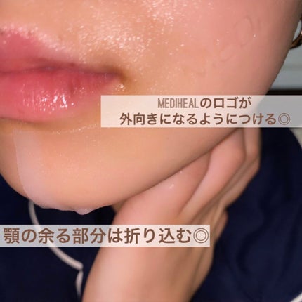 コラーゲン インパクト エッセンシャルマスクEX/MEDIHEAL/シートマスク・パックを使ったクチコミ(4枚目)