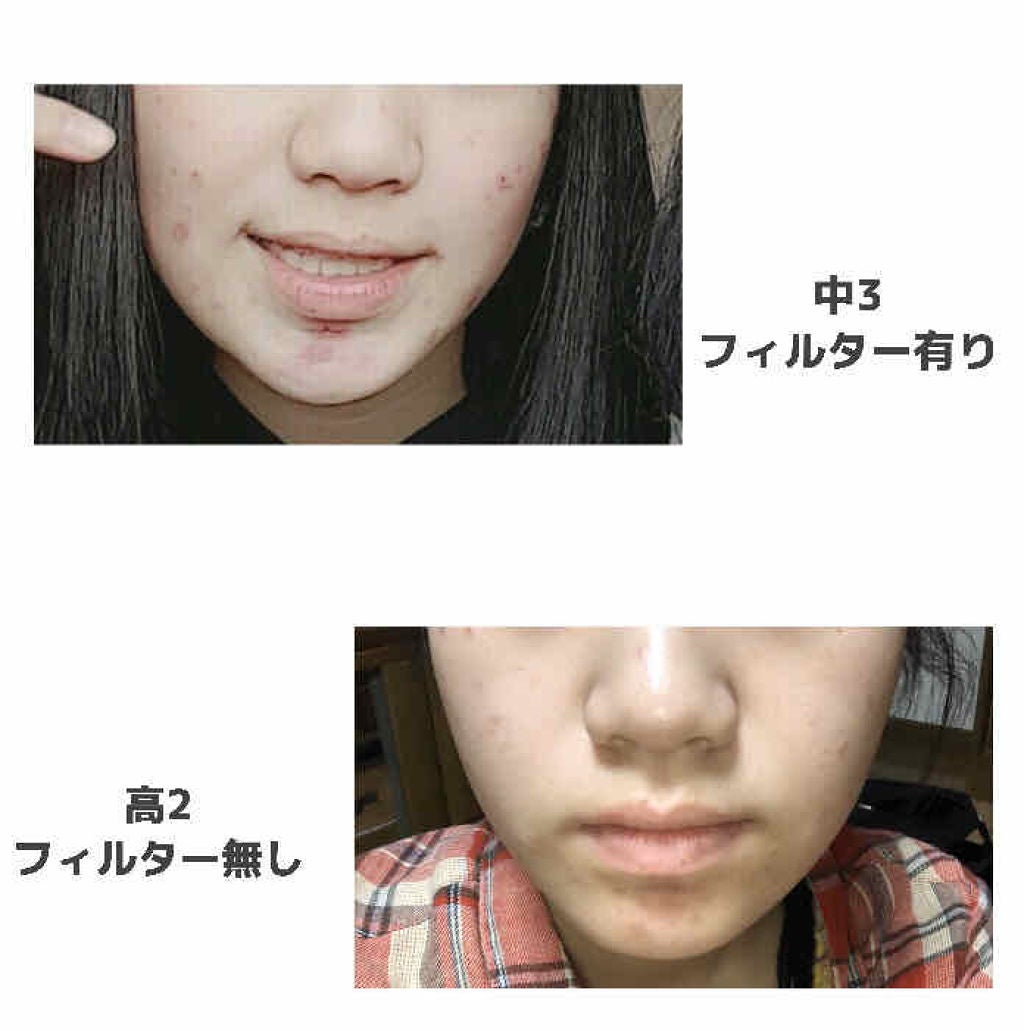 チョコラBBプラス (医薬品)/チョコラBB/その他を使ったクチコミ(2枚目)