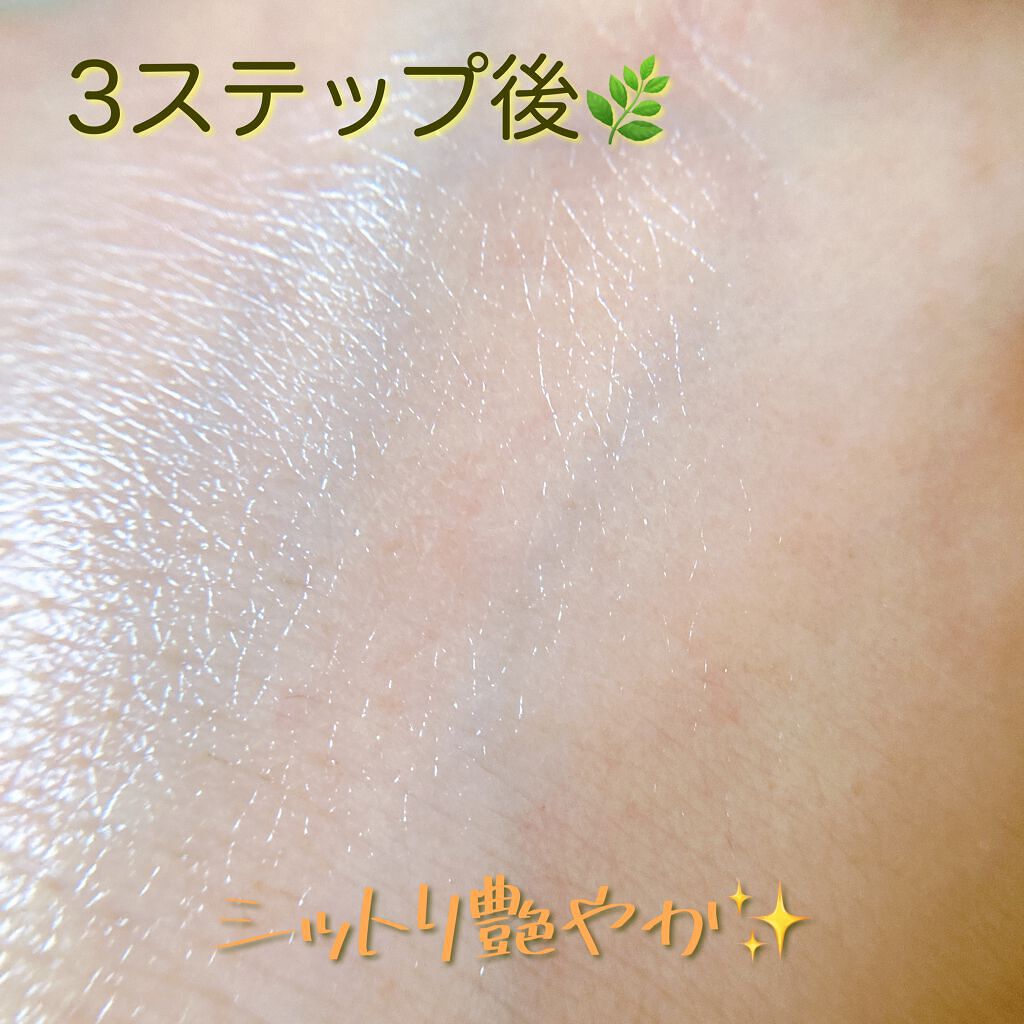 メグ on LIPS 「✼••┈┈┈┈••✼••┈┈┈┈••✼triagebeaute..」(10枚目)