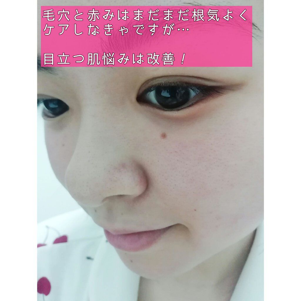 ミノン アミノモイスト モイストチャージ ミルク/ミノン/乳液を使ったクチコミ(3枚目)