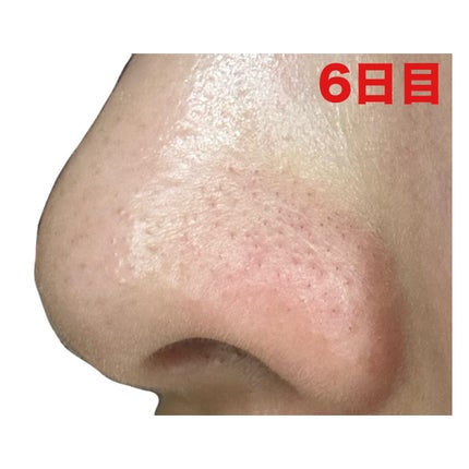 3番 緑茶炭毛穴パッククレンジングバーム/numbuzin/クレンジングバームを使ったクチコミ(8枚目)