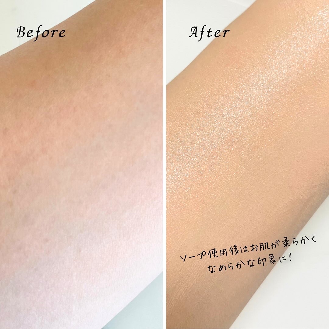 フェムチャー　ミルクミスト/アンファー(スカルプD)/ボディミルクを使ったクチコミ（3枚目）