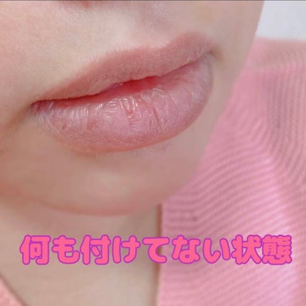 エッセンス リッププランパー/Visée/リッププランパーを使ったクチコミ(2枚目)