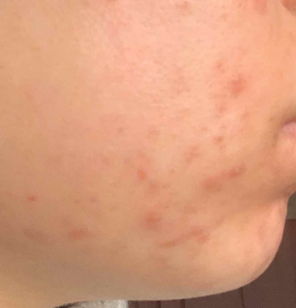 ãŽãã¿ãð± on LIPS ããã¯ããããããŸãâæ¬æ¥ã¯ããšããã¥ãªã²ã«2æ¥ç®ã§ãïŒçžå€ãã..ãïŒ2æç®ïŒ