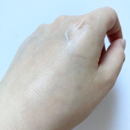 アクニドクターファーストスピーディースポット/ISOI/美容液を使ったクチコミ(5枚目)