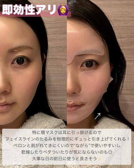 ayaka on LIPS 「\貼るボトックス/⠀⠀と韓国で言われているらしい3層構造のハイ..」(4枚目)