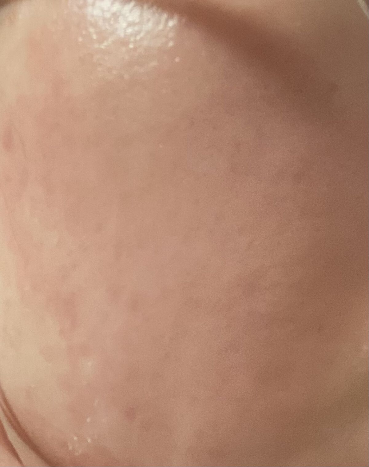 レチノールA 1% アドバンスドリバイタリゼーションクリーム/Life-flo/フェイスクリームを使ったクチコミ（3枚目）