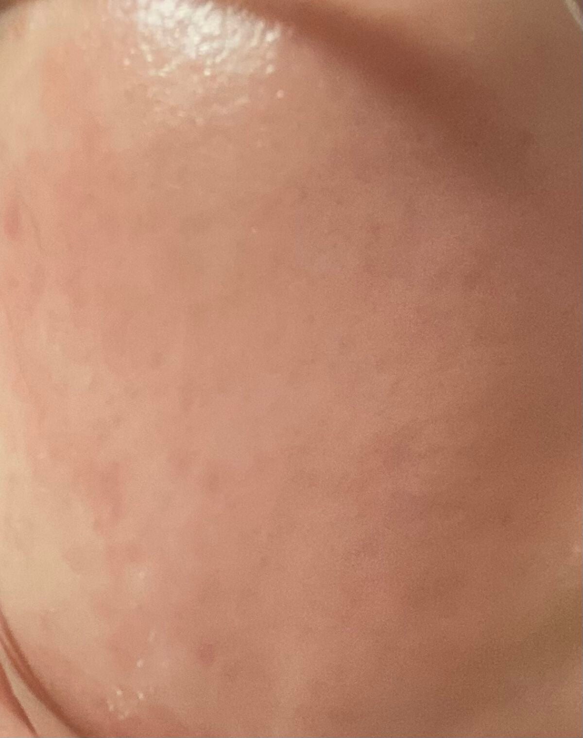 レチノールA 1% アドバンスドリバイタリゼーションクリーム/Life-flo/フェイスクリームを使ったクチコミ(3枚目)