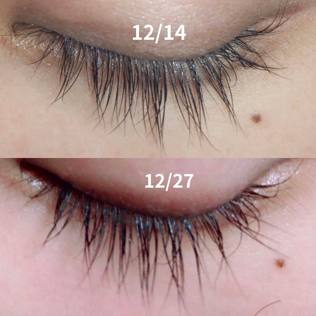 DHCアイラッシュトニック/DHC/まつげ美容液を使ったクチコミ(1枚目)