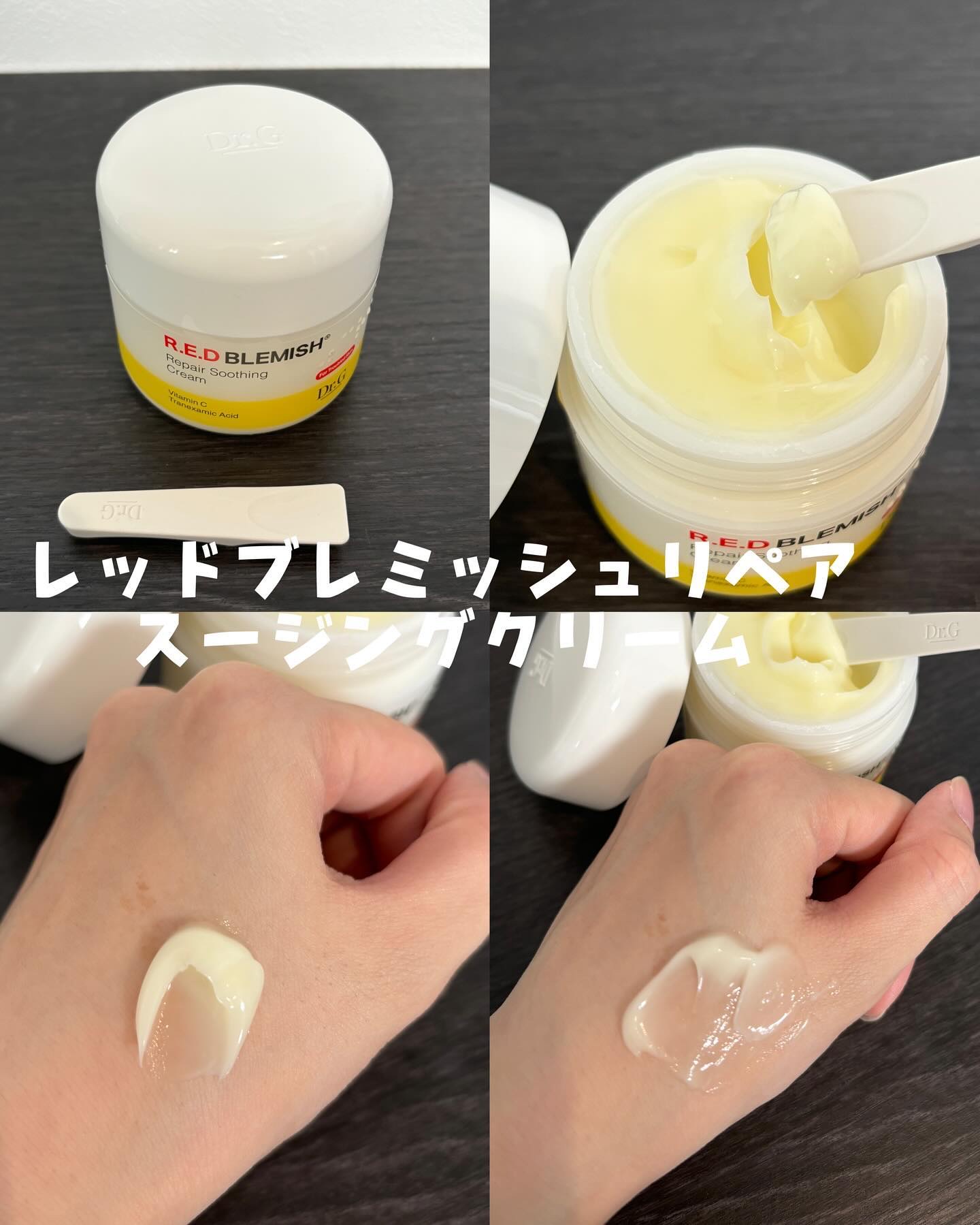 エイクリアスポットキュアパッチ/Dr.G/その他スキンケアを使ったクチコミ（3枚目）