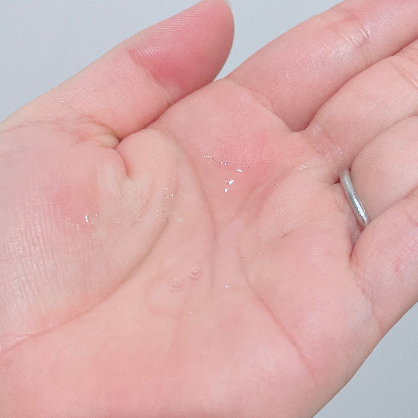 オイデルミン エッセンスローション/SHISEIDO/化粧水を使ったクチコミ(2枚目)