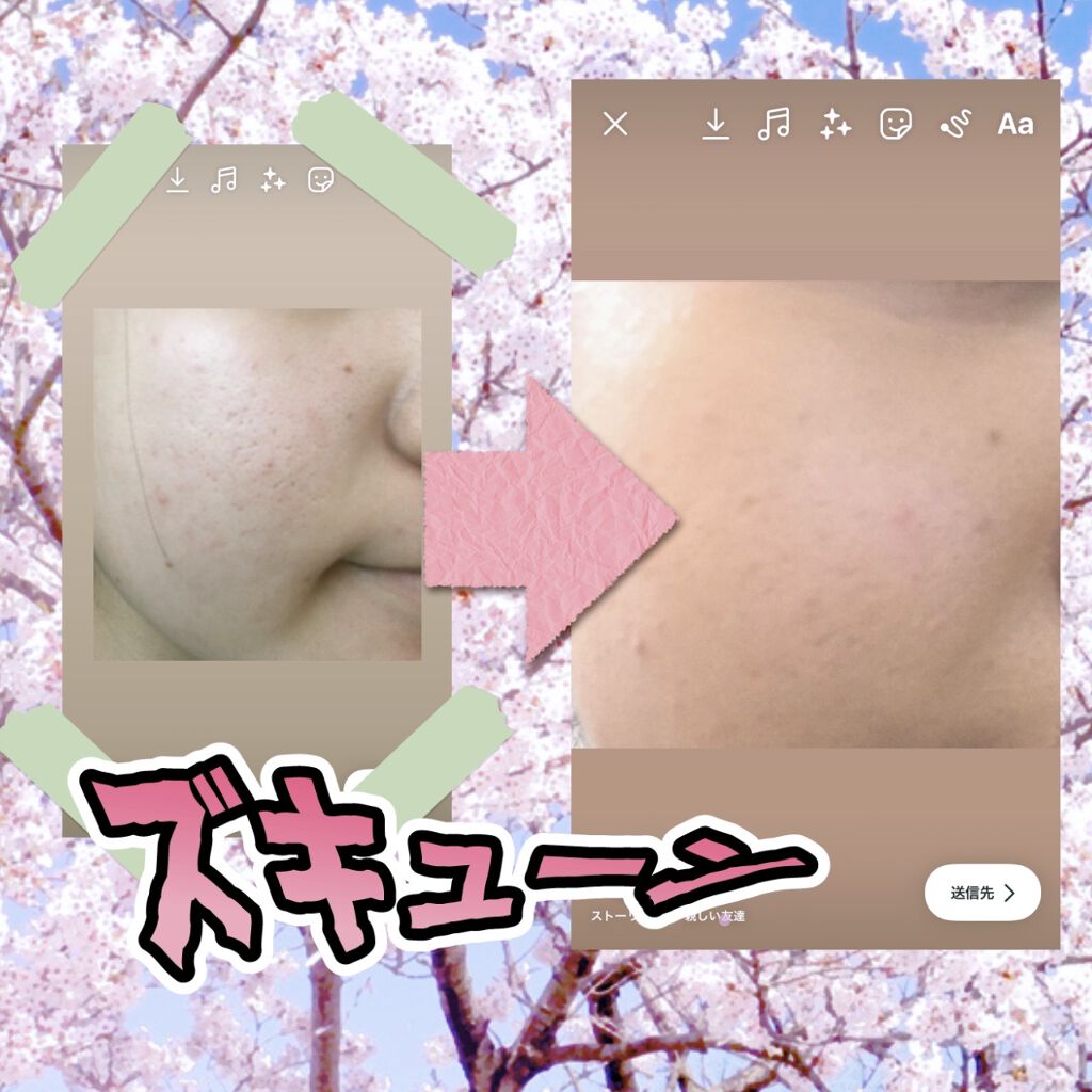 を使ったクチコミ（1枚目）