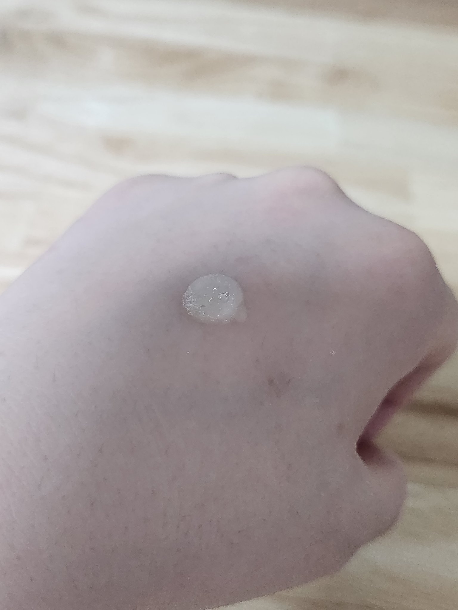 ダーマテカバイオームセラム/THE A'VVE/美容液を使ったクチコミ（3枚目）