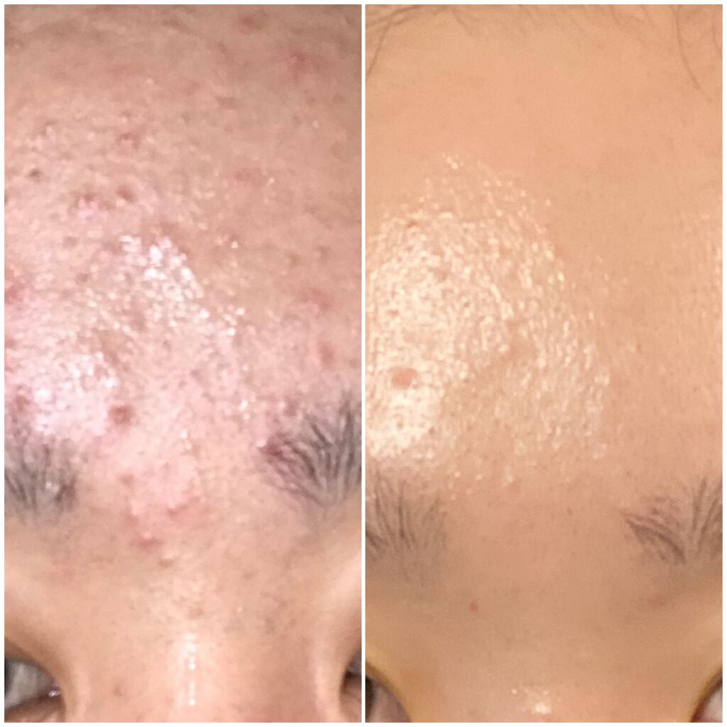 ボタニカルジェルクレンジング/NICE ＆ QUICK/クレンジングジェルを使ったクチコミ（2枚目）