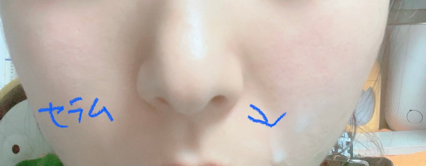 復活草ビフィダセラムファーミングドロップ/Abib /美容液を使ったクチコミ(4枚目)