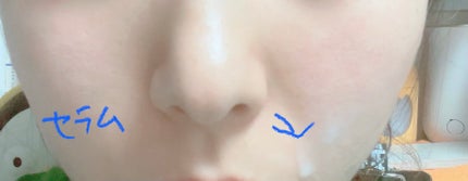 復活草ビフィダセラムファーミングドロップ/Abib /美容液を使ったクチコミ(4枚目)