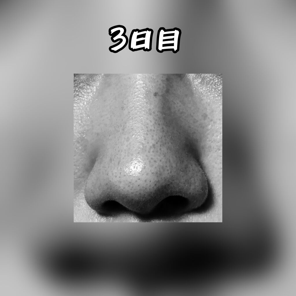 デュオ ザ クレンジングバーム ブラック/DUO/クレンジングバームを使ったクチコミ（3枚目）