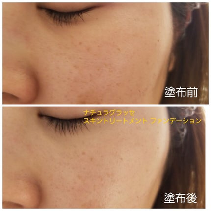 スキントリートメント ファンデーション/ナチュラグラッセ/リキッドファンデーションを使ったクチコミ(4枚目)