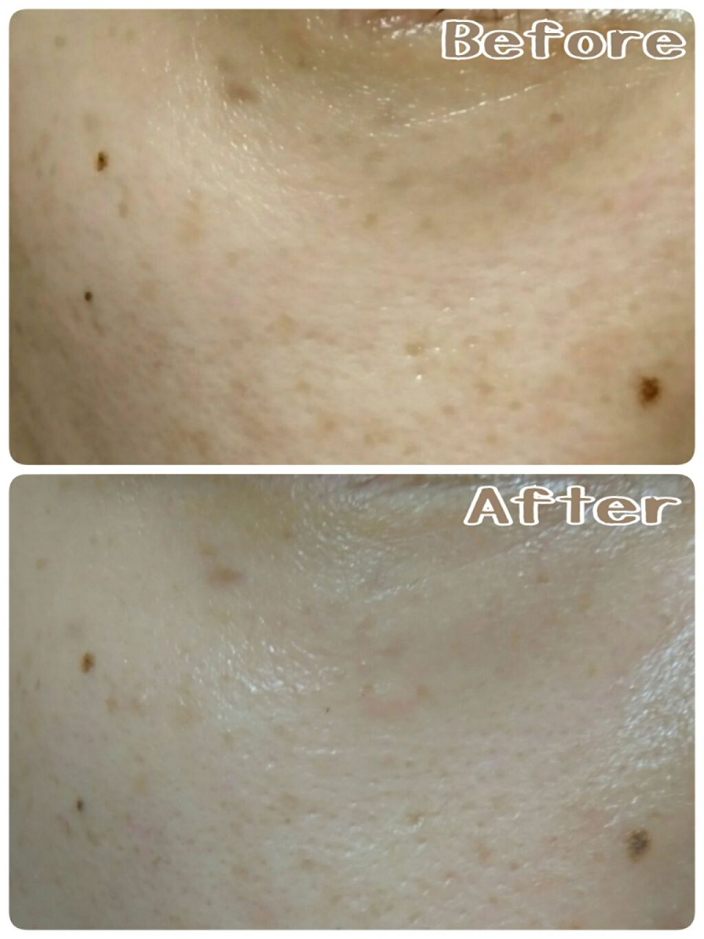 エリクシール ホワイト リセット ブライトニスト/エリクシール/フェイスクリームを使ったクチコミ（2枚目）