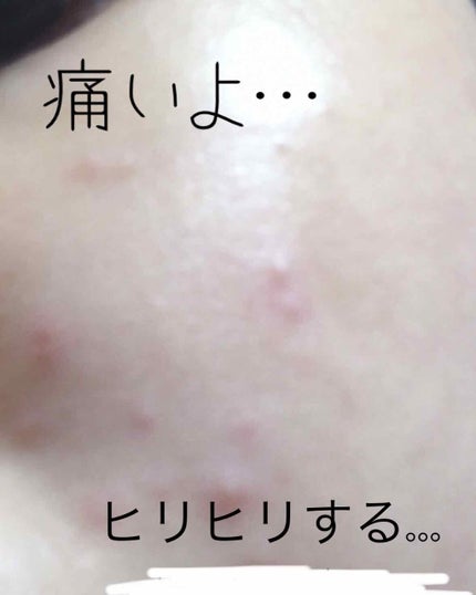 お疲れさマスク/サボリーノ/シートマスク・パックを使ったクチコミ(2枚目)