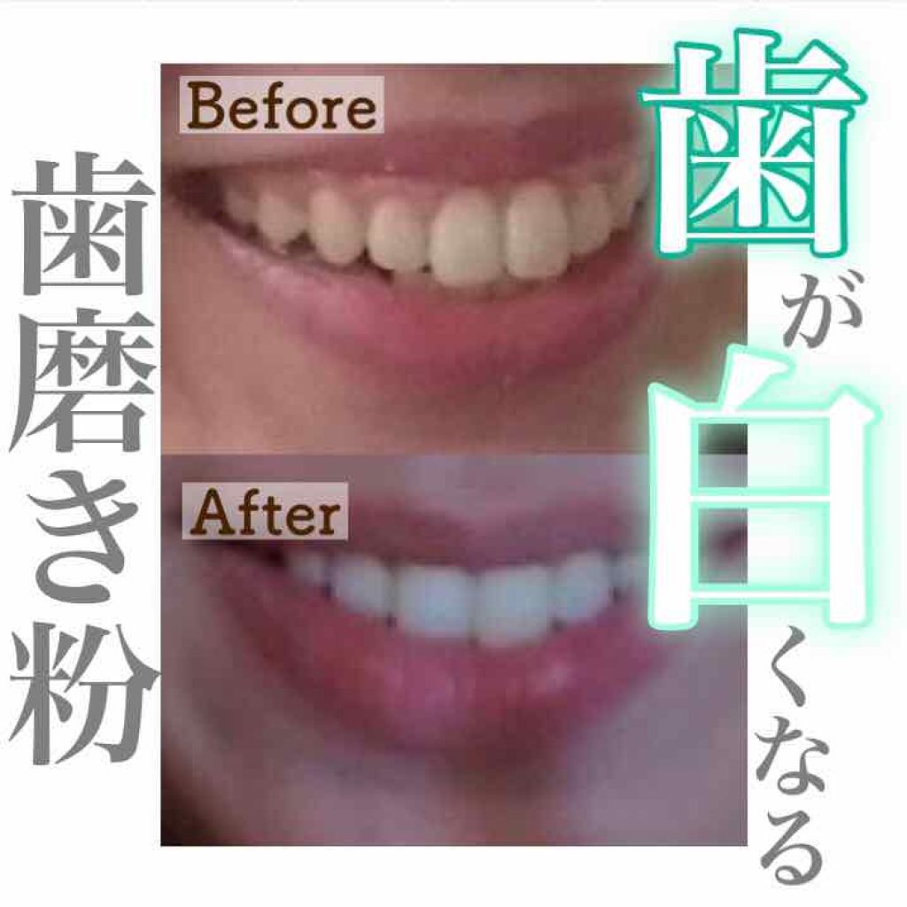 XyliWhite Toothpaste Gel Platinum Mint/Now Foods/歯磨き粉を使ったクチコミ(1枚目)