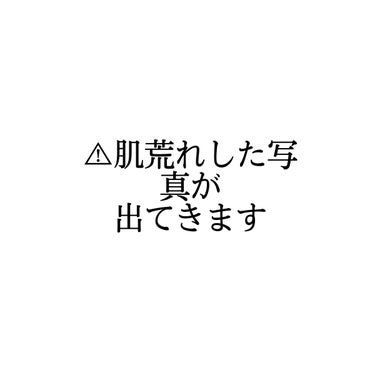 サイムダン プレミアム  CICAフェイス＆ボディクリームのクチコミ「＼正直レビュー／サイムダン プレミアムCICAフェイス＆ボディクリーム💭


アトピー肌の、私.....」（2枚目）