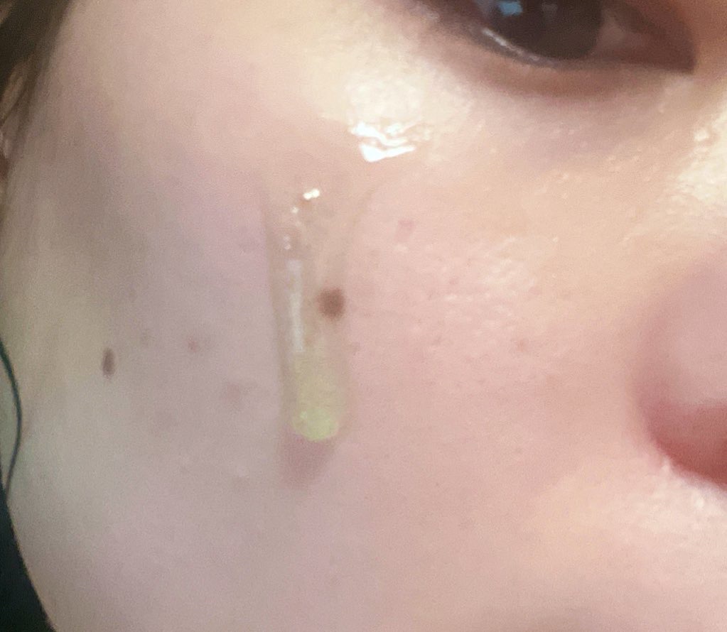 エクソソームシカ アンプル/MEDICUBE/美容液を使ったクチコミ（3枚目）