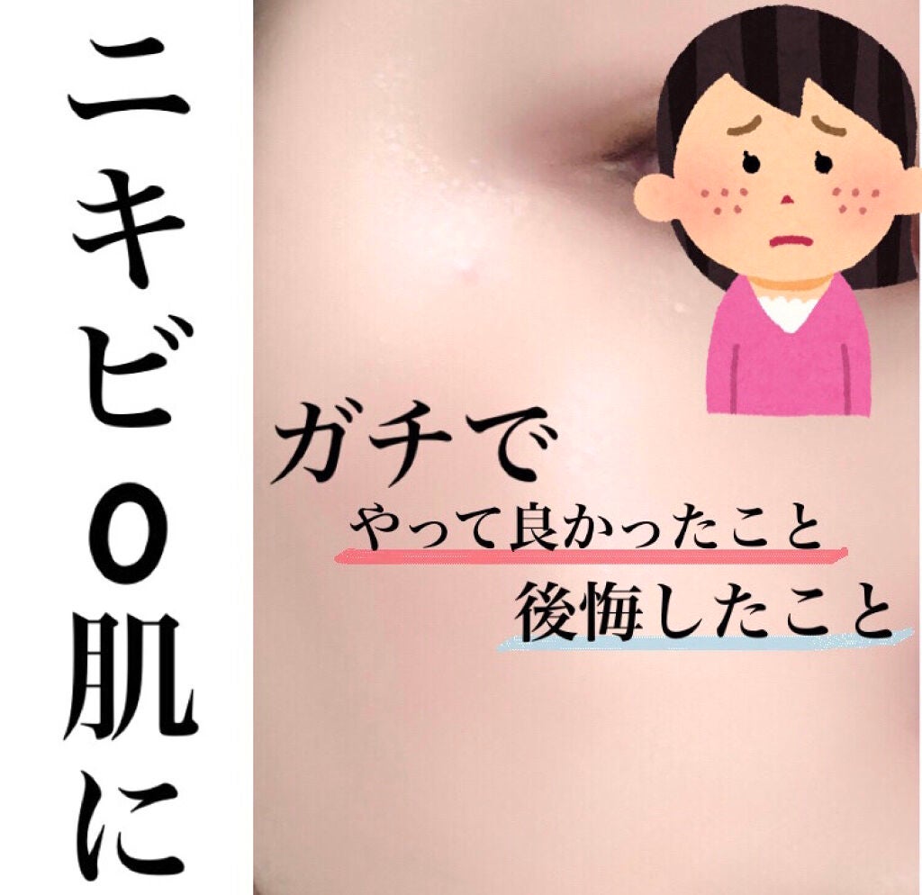 ペアアクネクリームW(医薬品)/ペア/その他を使ったクチコミ(1枚目)