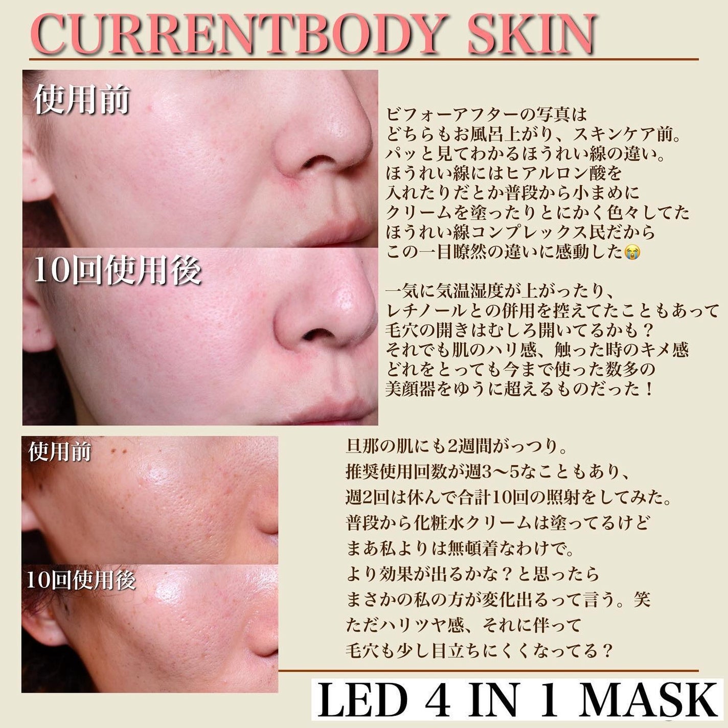 試してみた】LED 4 イン 1 マスク CurrentBodyのリアルな口コミ 試してみた】LED 4 イン 1 マスク CurrentBodyのリアルな口コミ