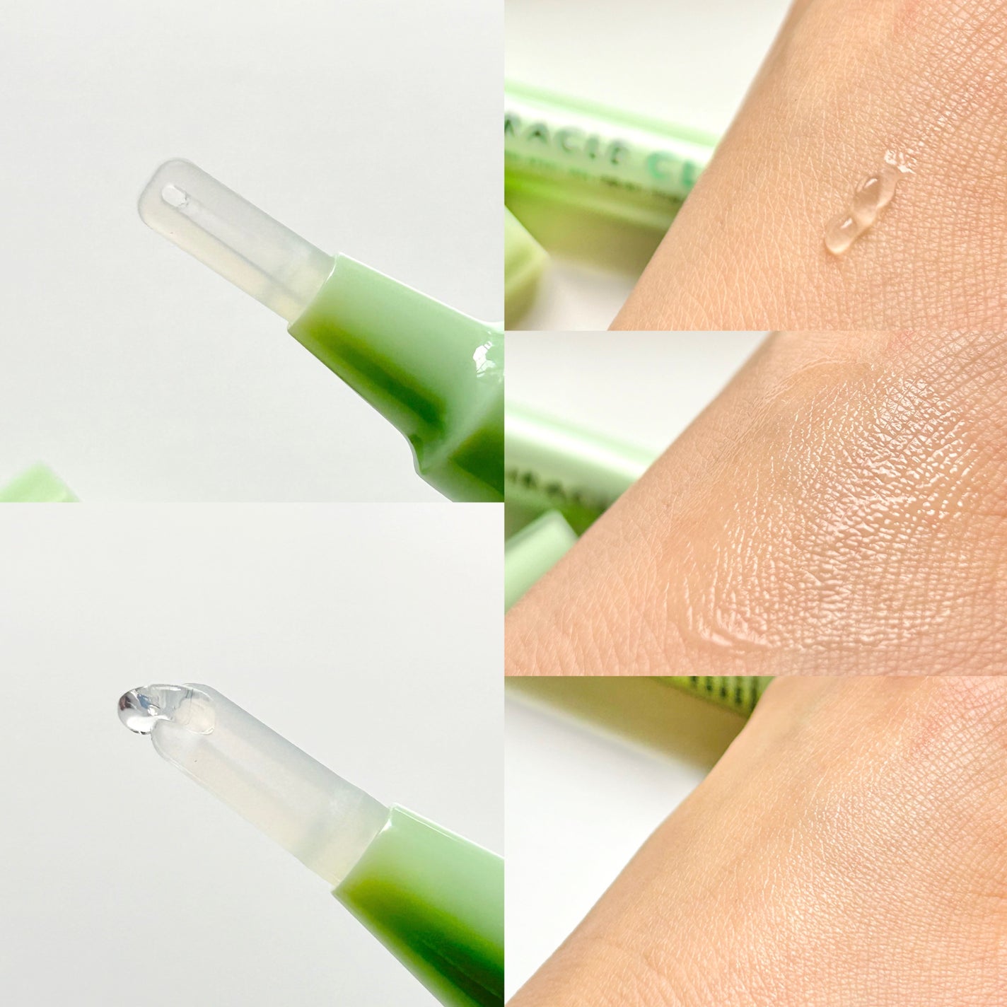 ミラクルクリアスージングスポットジェル/Rael/にきびパッチを使ったクチコミ(5枚目)