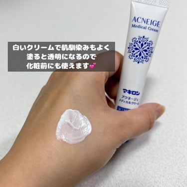 マキロン  マキロン アクネージュ メディカルクリーム	(医薬品）	のクチコミ「#プロモーション
#第一三共ヘルスケアから提供いただきました
#RSPに参加しました
#rsp.....」（3枚目）