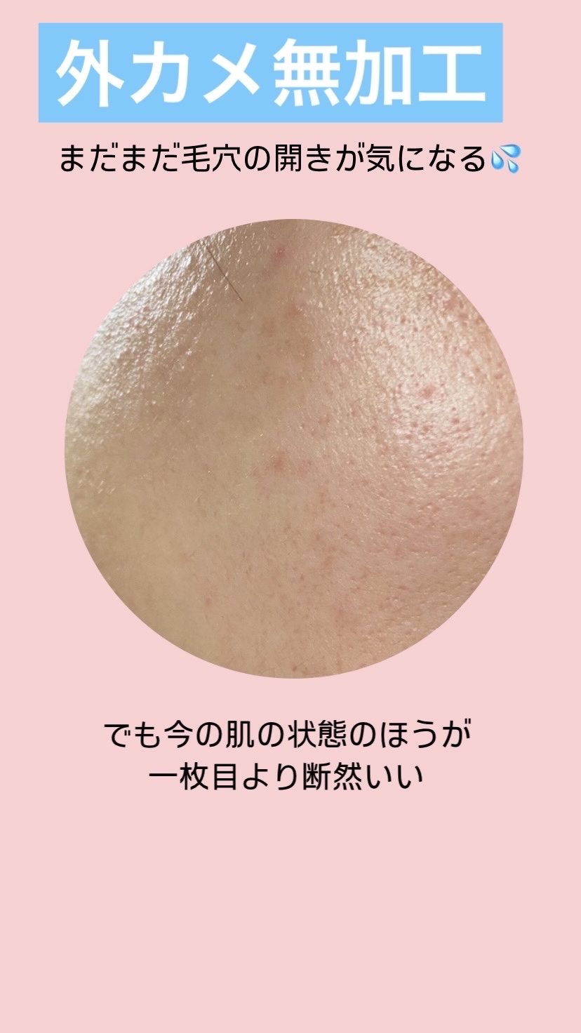  ピュア ヒアルロン酸 セラム/Cosmedica/美容液を使ったクチコミ（2枚目）