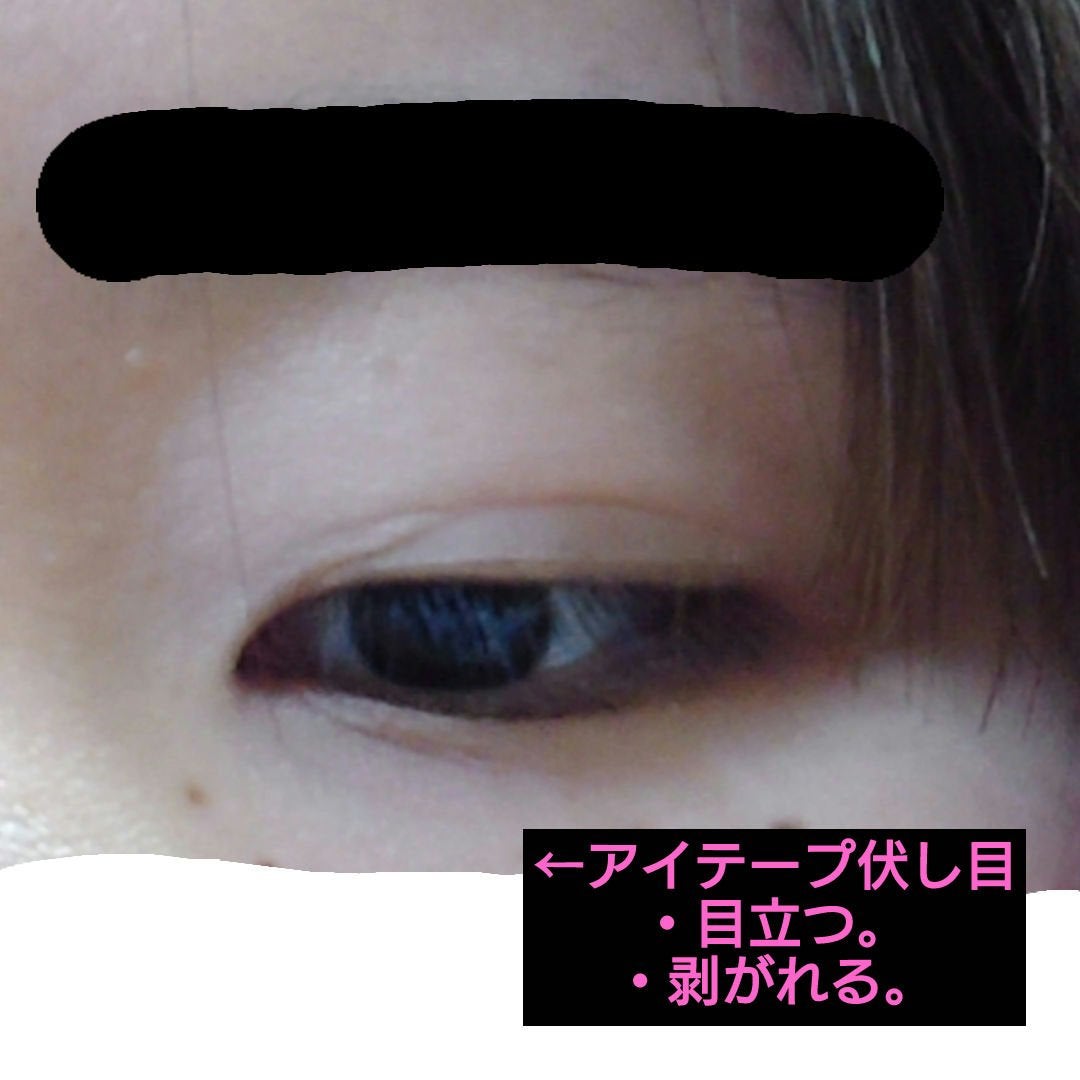 ナチュラルヌードアイテープII スリム/ドリームマジック/二重まぶた用アイテムを使ったクチコミ(3枚目)