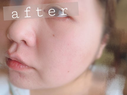 マシュマロフィニッシュパウダー ~Abloom~/キャンメイク/プレストパウダーを使ったクチコミ(5枚目)