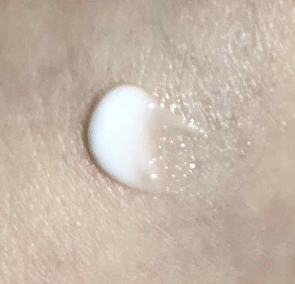 ペアアクネクリームW(医薬品)/ペア/その他を使ったクチコミ（3枚目）