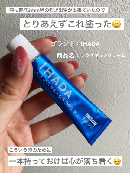 アクネキュアクリーム(医薬品)/IHADA/その他を使ったクチコミ(1枚目)