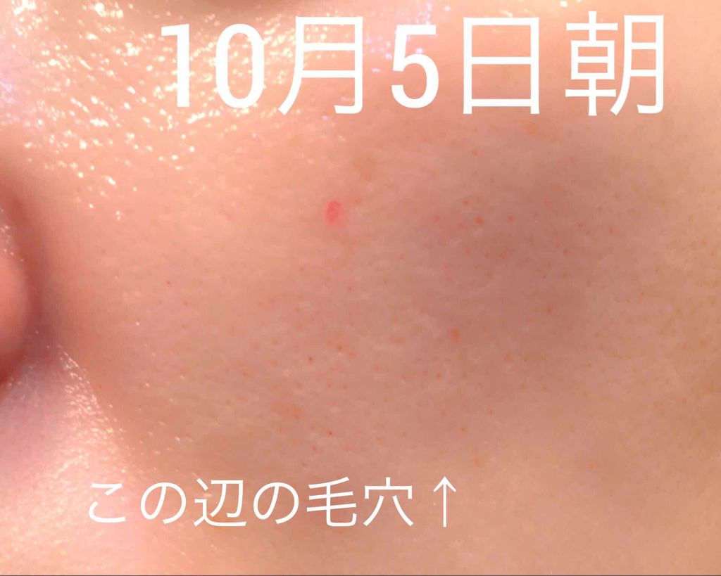 スムースローション/skinvill/化粧水を使ったクチコミ（2枚目）