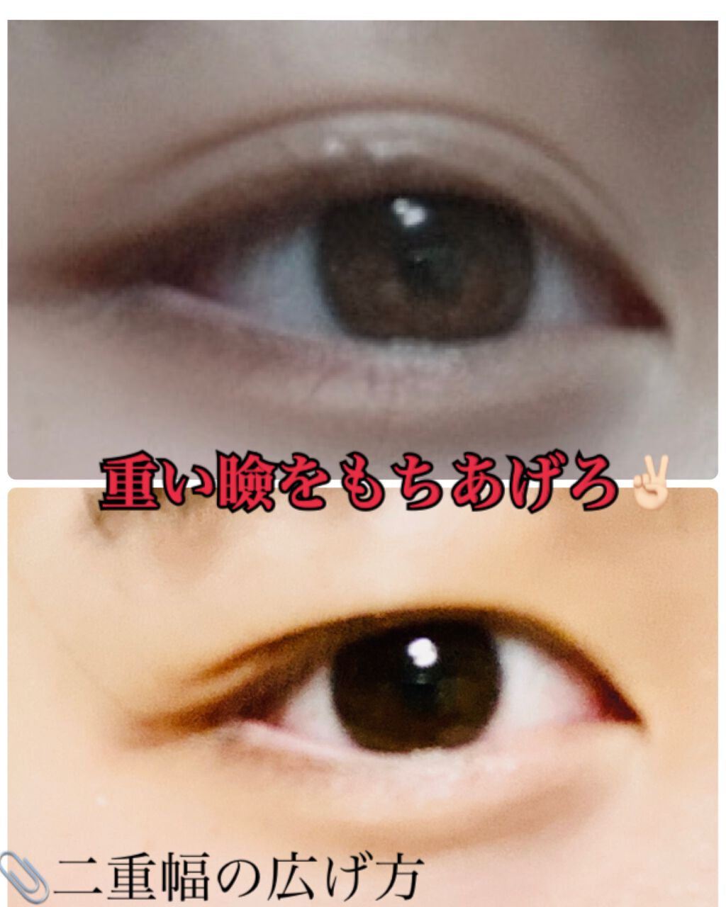 アイビューティー フィクサー WP/アストレア ヴィルゴ/二重まぶた用アイテムを使ったクチコミ（1枚目）