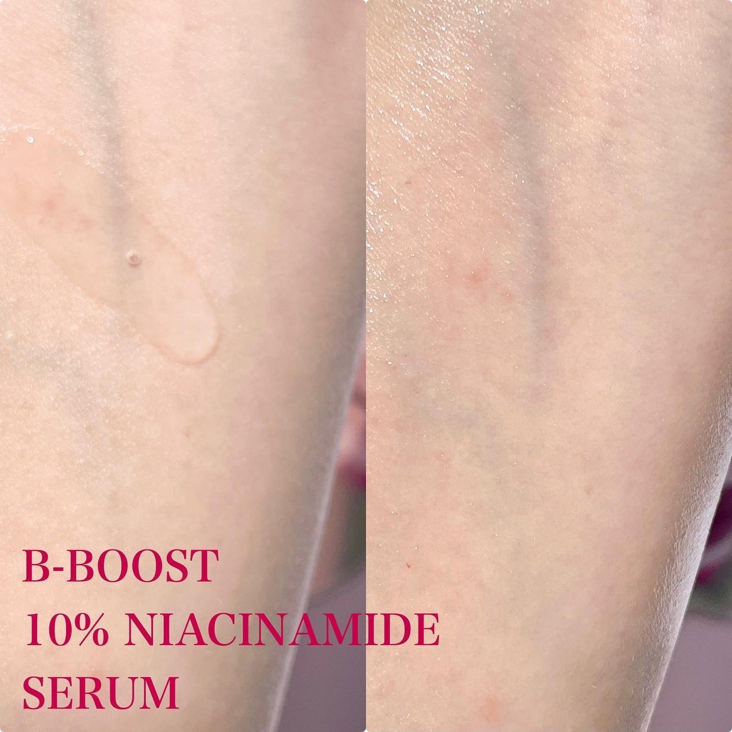 pi on LIPS 「✴︎NINELESSB-Boost10%ナイアシンアミドセラム..」(3枚目)