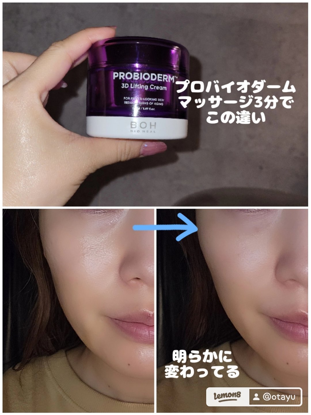 BIOHEAL BOH プロバイオダーム リフティング クリームのクチコミ「今日はばえない写真をあげてまで推したいクリームがあるので聞いてほしい。

バズってるから今更？.....」（2枚目）