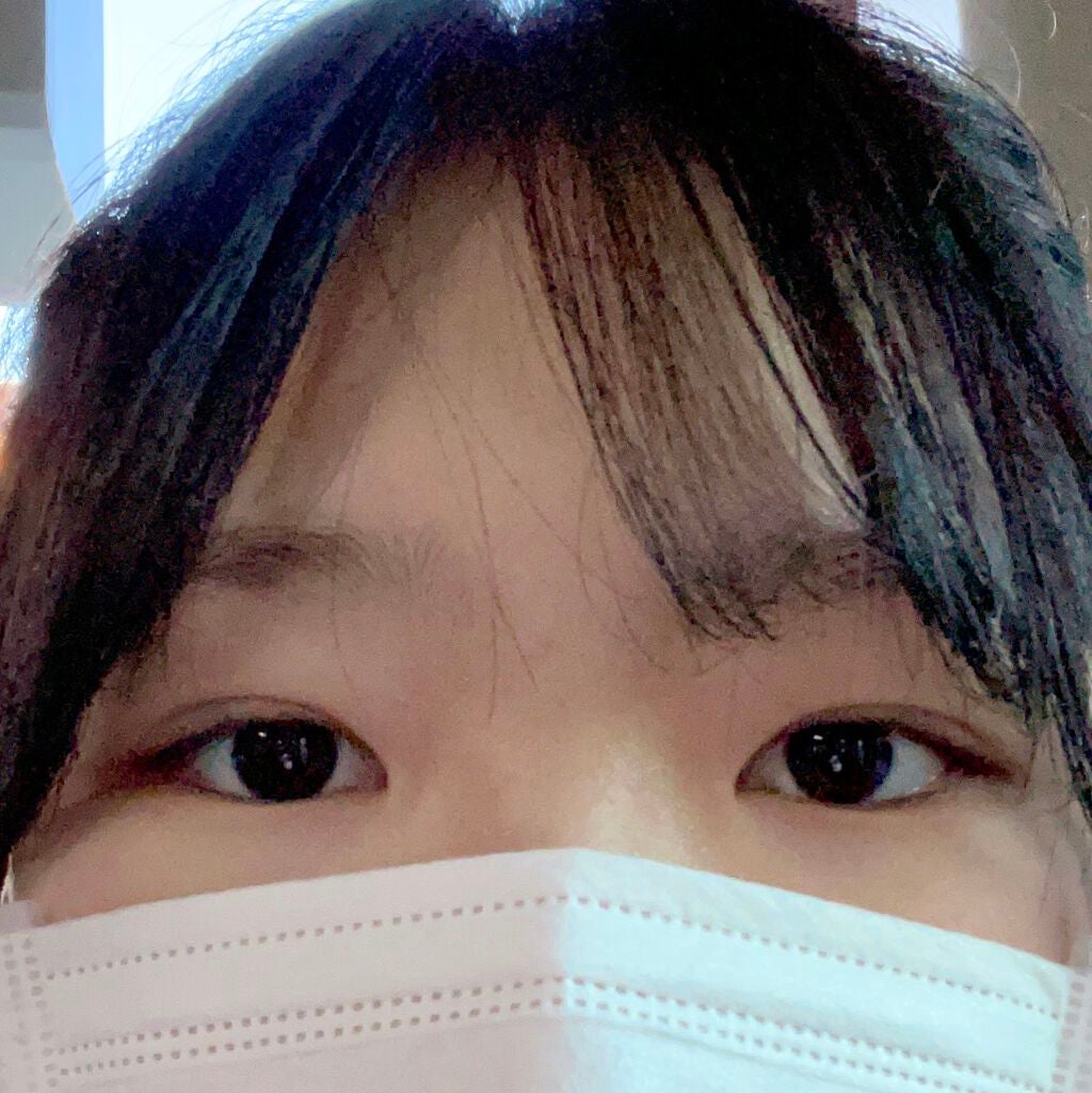 しろもち on LIPS 「埋没してから2ヶ月!これはすっぴんの時の目です!(出先で撮った..」(1枚目)