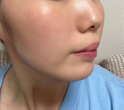 ユース ラディアンス ビタチノール セラム/primera/美容液を使ったクチコミ(5枚目)