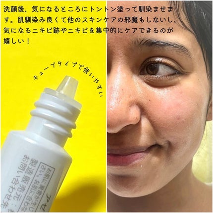 AZ アゼフィットスポッツ/NIKI PITA/フェイスクリームを使ったクチコミ(8枚目)