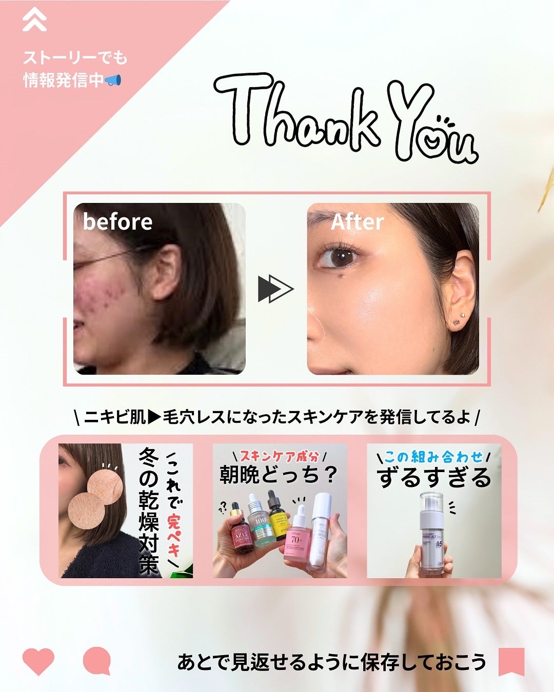 ピンクティーツリーシナジーセラム/APLIN/美容液を使ったクチコミ(8枚目)