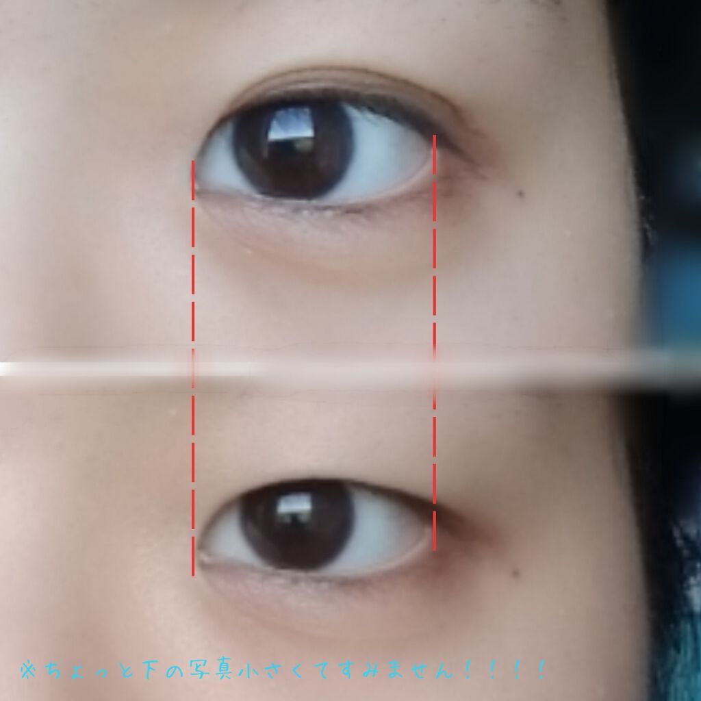 ワンダーアイリッドテープ Extra/D-UP/二重まぶた用アイテムを使ったクチコミ（2枚目）