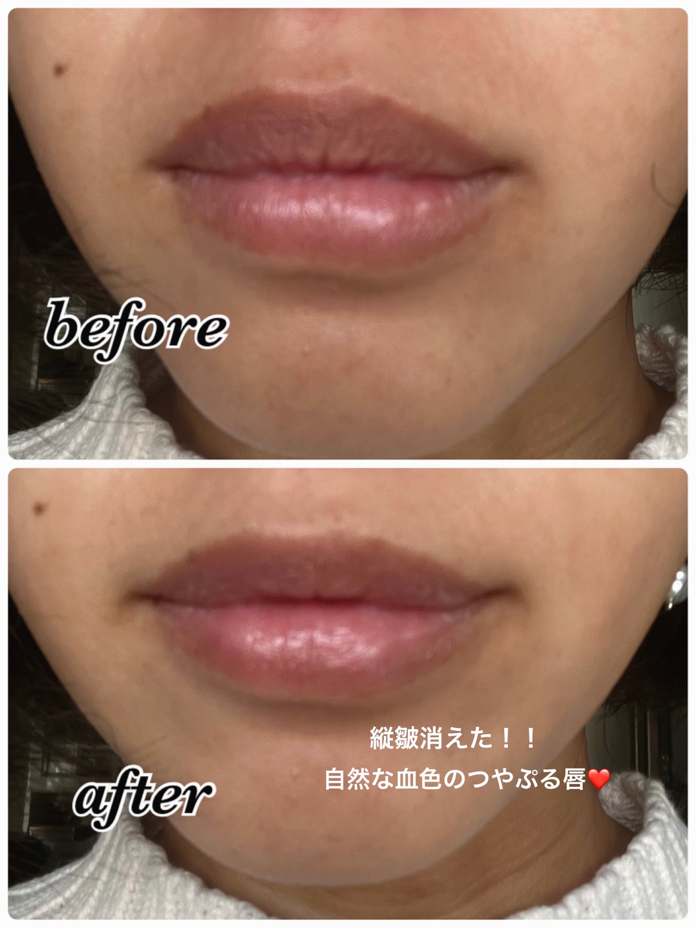 リップ スクラブ & バーム/Visée/リップバームを使ったクチコミ(4枚目)