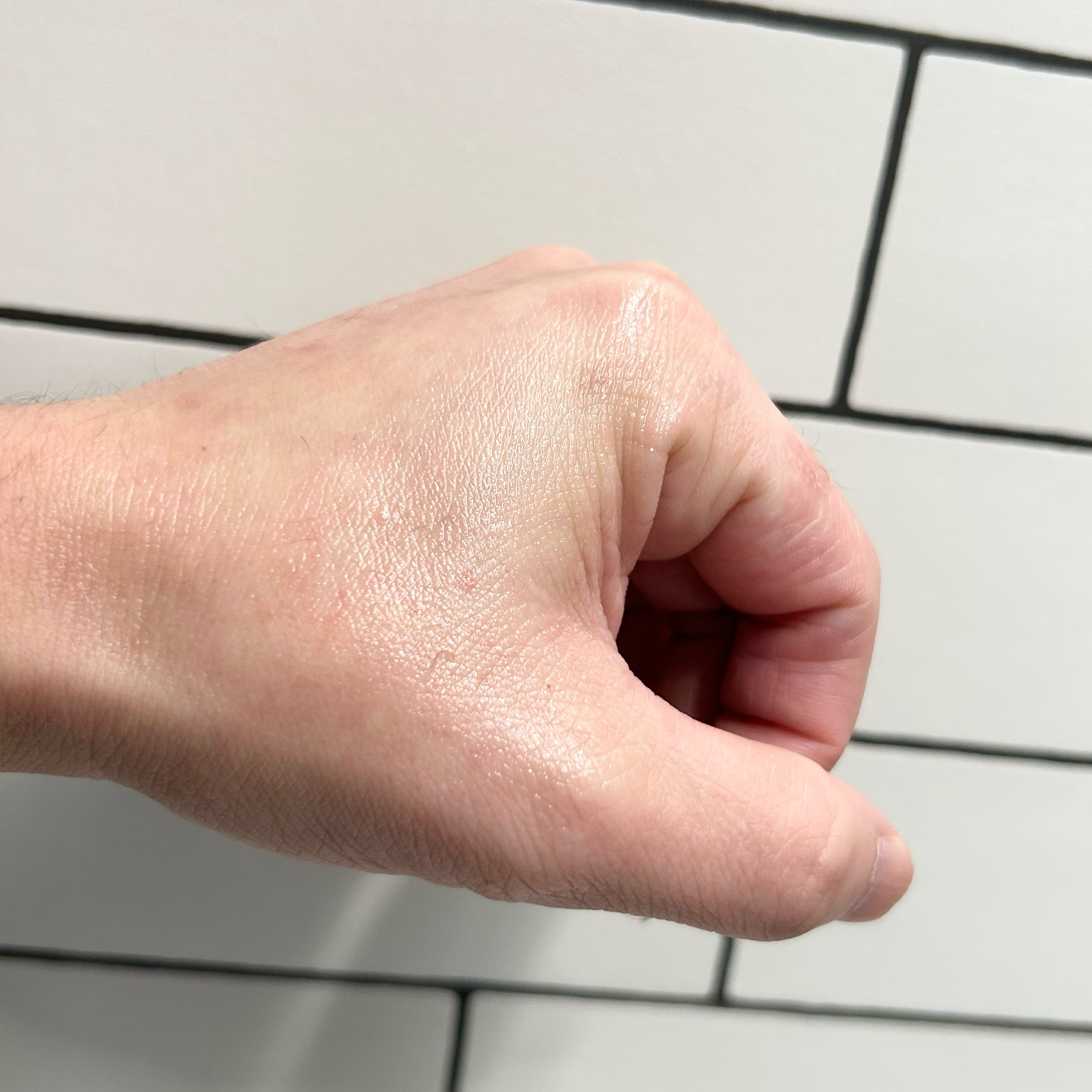 ピンクティーツリートナー/APLIN/化粧水を使ったクチコミ（2枚目）